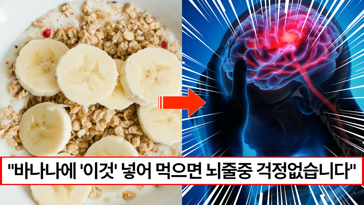 “바나나와 함께 드세요” 같이 먹게 되면 병든 혈관이 튼튼해지고 뇌줄중 예방하는 보약이 됩니다